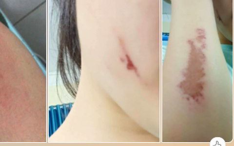 Yêu cầu báo cáo vụ nữ sinh bị đánh ở phòng nội trú