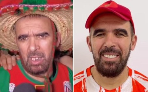 Người hâm mộ World Cup bị 'bắt nạt' vì răng xấu được nha sĩ chữa miễn phí