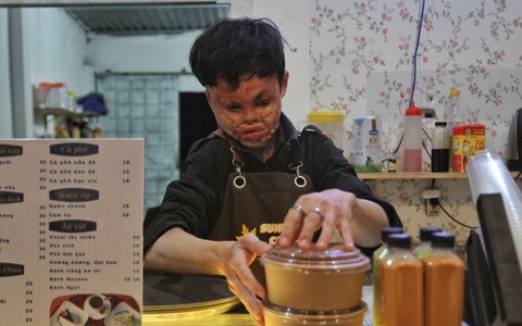 Phép mầu của cậu bé 'không có khuôn mặt'