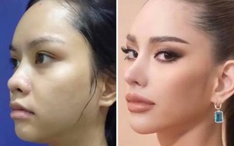 Netizen cười cợt hình ảnh chưa 'dao kéo' của tân Hoa hậu Hoàn vũ Thái Lan