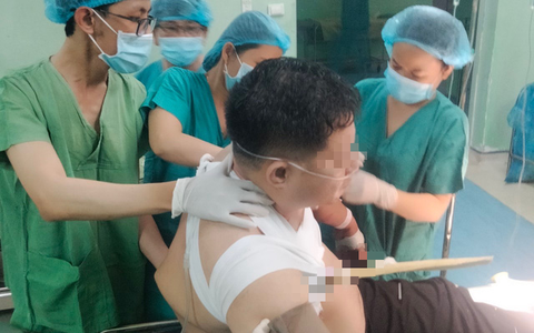 Cứu sống người đàn ông bị cây gỗ đâm xuyên ngực
