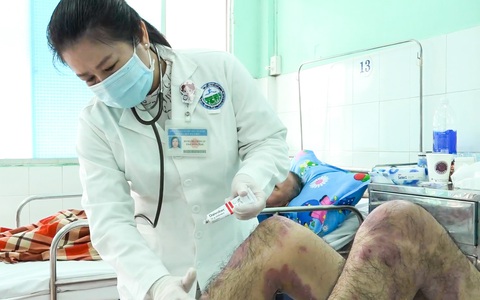 Nghe 'thầy' trên mạng, người bệnh vảy nến bị tróc vảy toàn thân