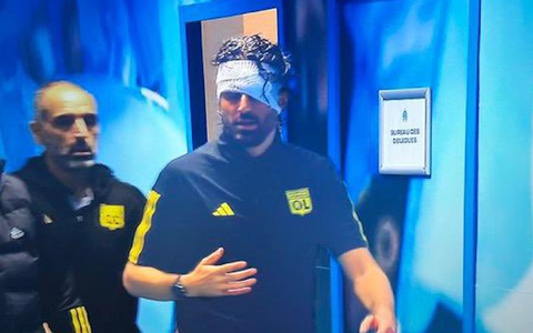 Cổ động viên tấn công xe buýt, hoãn trận Marseille - Lyon ở giải Ligue 1