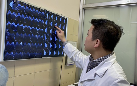 Cho con bú sai cách, cai sữa 2 năm vẫn bị tắc tuyến sữa
