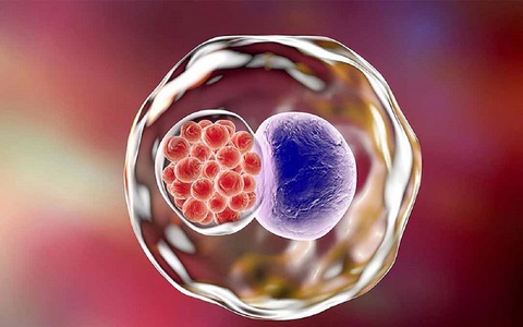 Cẩn thận vô sinh do vi khuẩn viêm nhiễm đường sinh dục