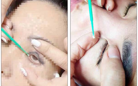 Nghe dụ bắt 'sâu mắt', coi chừng hư luôn mắt