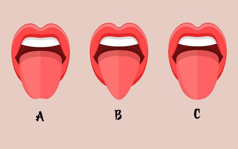 Hình dáng lưỡi bật mí tính cách thú vị của bạn