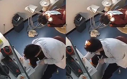 Bác sĩ nha khoa bị cháy tóc vì lơ đễnh
