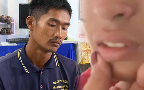 Tạm giữ hình sự cha dượng đốt dương vật, hành hạ con riêng của vợ ở An Giang