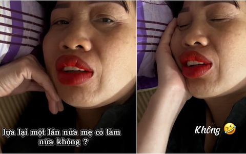 Con gái trêu chọc khi thấy mẹ phun môi sưng tấy