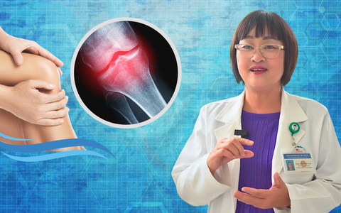 Bác sĩ tư vấn: Cách phòng ngừa thoái hóa khớp mà bạn nên biết sớm