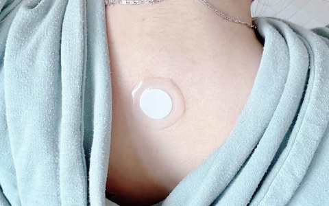 Nghệ sĩ lại quảng bá miếng dán kích hoạt tế bào gốc ‘thải độc cơ thể’, chuyên gia phản đối