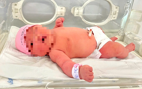 Bé gái chào đời nặng gần 6kg, nên cẩn trọng khi mang thai quá lớn