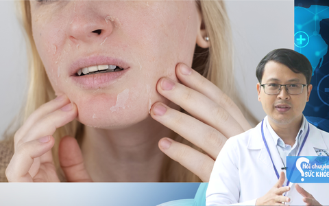Cách phân biệt khô da đơn thuần và khô da do bệnh lý
