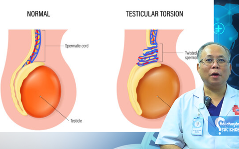 Xoắn dây tinh và thời gian vàng cấp cứu