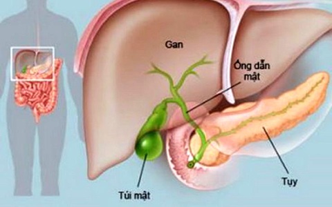 Viêm tụy cấp: Máu đục như sữa