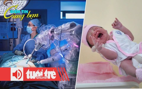Điểm tin 8h: Robot xem video học phẫu thuật; Thế giới bắt đầu có thế hệ Gen Beta