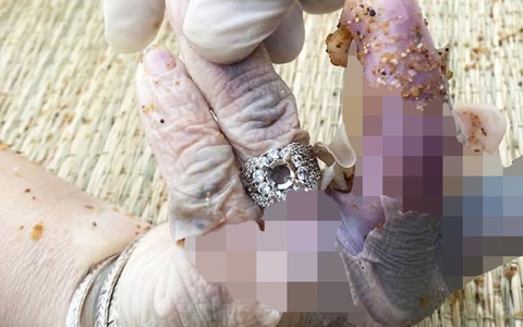 Thi thể nữ không đầu, không chân dạt vào bãi biển là người Đà Nẵng, nghi bị giết