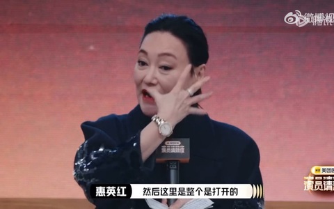 'Đả nữ' Huệ Anh Hồng phẫu thuật thẩm mỹ vì phải khâu 89 mũi trên mặt