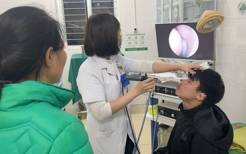 Phẫu thuật cho nam sinh bị đánh gãy mũi giữa đường