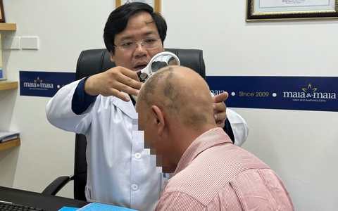Rụng tóc cả mảng, có điều trị được không?