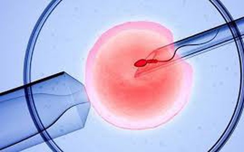 Em bé đầu tiên trên thế giới chào đời nhờ IVF tự động điều khiển từ xa