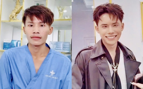 Lai Thai khoe diện mạo mới sau thẩm mỹ