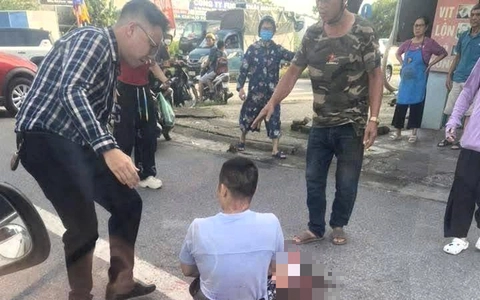 Một TikToker bị chém gần đứt lìa bàn tay