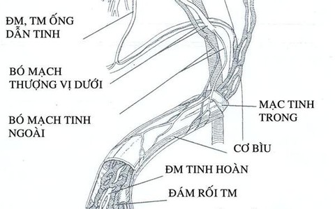 Giãn tĩnh mạch thừng tinh và vô sinh nam