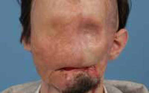 Sống với gương mặt người chết