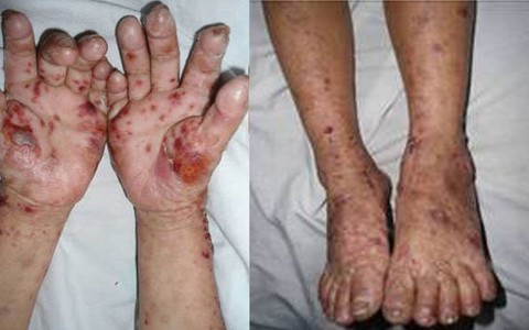 Bệnh "lạ" không chỉ ở Quảng Ngãi