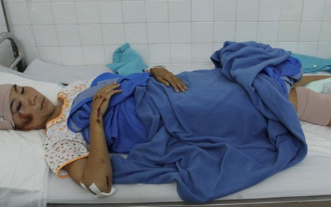 VĐV Trương Thanh Hằng bị xe tông gãy chân
