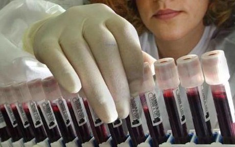 Mỹ: nạn nhân do virus tây sông Nile tiếp tục tăng