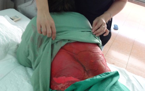 Thực phẩm chức năng cũng có thể gây hại