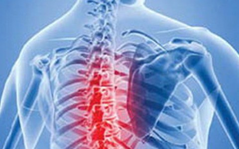 Nam giới viêm cột sống dính khớp nhiều hơn