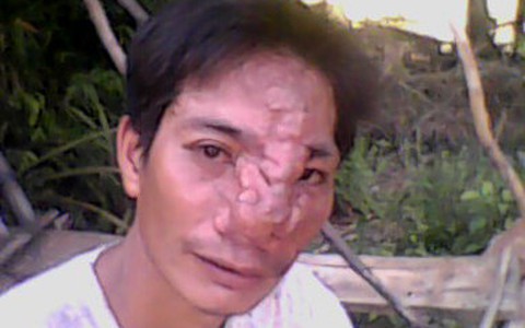 Chàng trai mũi "kỳ lân"