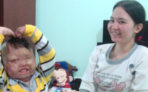 Cậu bé bị cha đốt và hành trình tìm lại tuổi thơ