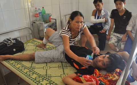 Bị khỉ tấn công trong khu du lịch, hai người bị thương