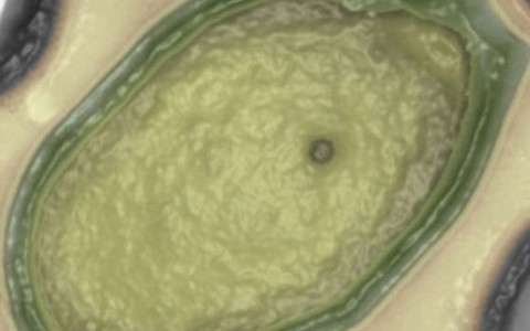 Phát hiện virus khổng lồ nhất thế giới