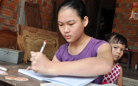 Bại não, vẫn học giỏi