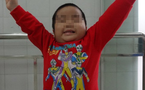 Trẻ liệt cánh tay sau sinh