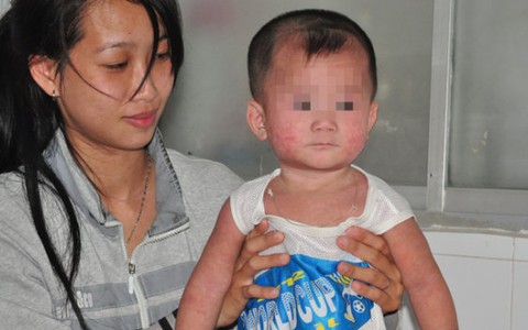 Đưa trẻ đi tiêm "vét" văcxin sởi