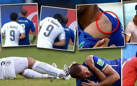 "Nên loại Suarez khỏi VCK World Cup 2014"