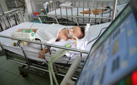 Những bệnh gây tổn thương não