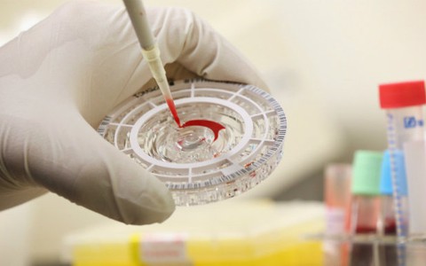 Pháp chế tạo thiết bị phát hiện Ebola trong 15 phút