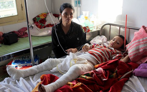 Cha chất rơm đốt con phỏng nặng