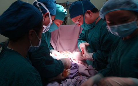 Sỏi gần một kg trong tiền liệt tuyến cụ ông 85 tuổi