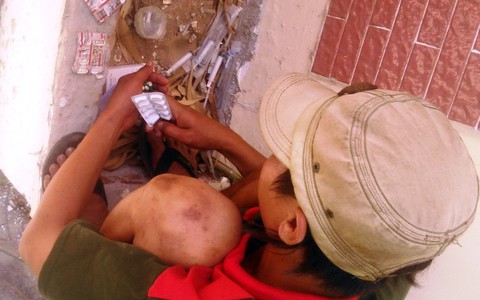 Điểm tin: Di-Angesic: Tân dược nguy hiểm