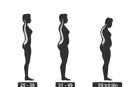 Những đối tượng dễ bị loãng xương