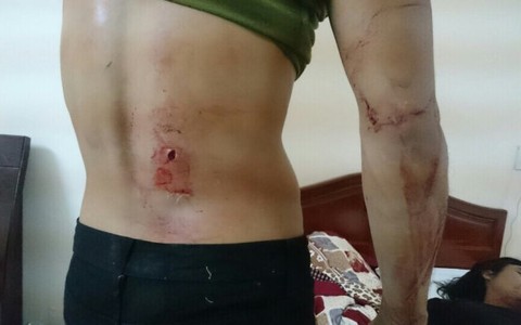 Thêm thông tin vụ cascadeur bị đâm chém tại Cần Thơ